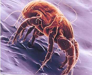 Should you be Worried about House Dust Mite (HDM) for your Eczema Child