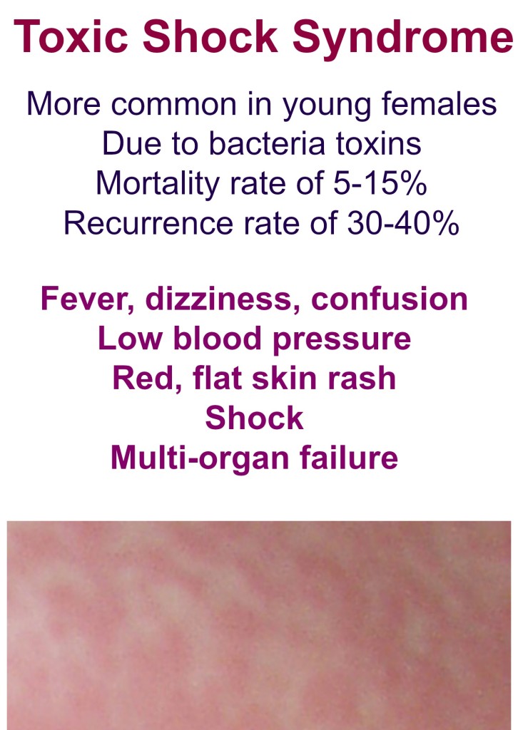 life-threatening-skin-rash-series-toxic-shock-syndrome-eczema-blues