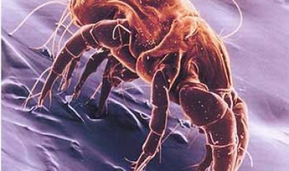 Should you be Worried about House Dust Mite (HDM) for your Eczema Child?